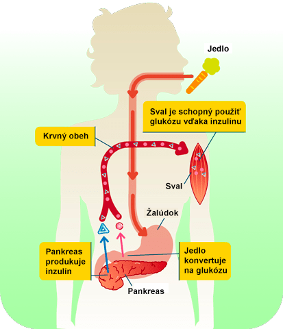 metabolický syndróm